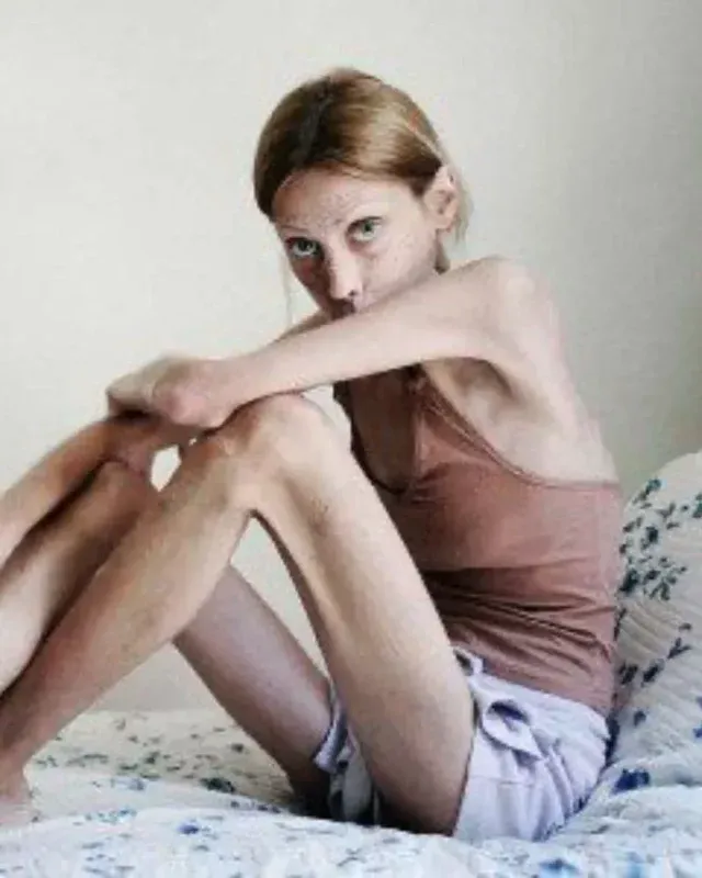 inline image
